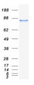 SDS-PAGE (STAT6-2916H).jpg